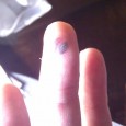 Last Friday was my final day of my annual National Service In-Camp Training (ICT). I managed to go 2 weeks with little incident then bang! I injure my finger badly...